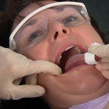рак слизистой полости рта - взятия мазка